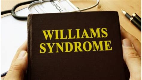 16 Interesting Facts About Williams Syndrome & Symptoms + Causes ...