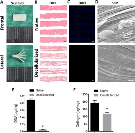 Bookshaped Decellularized Tendon Matrix Scaffold Combined With Bone