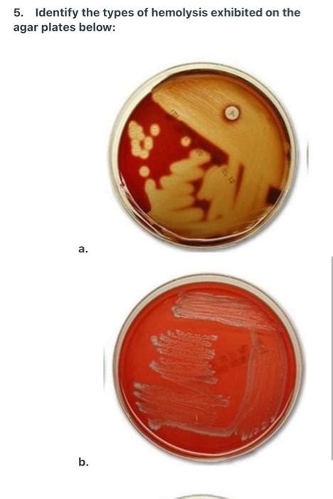 Solved 4. Name and describe three types of hemolysis found | Chegg.com