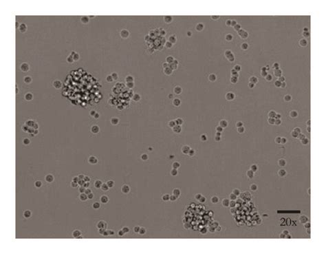 Glioblastoma Stem Cells Screening A Culture In Enriched Medium Of