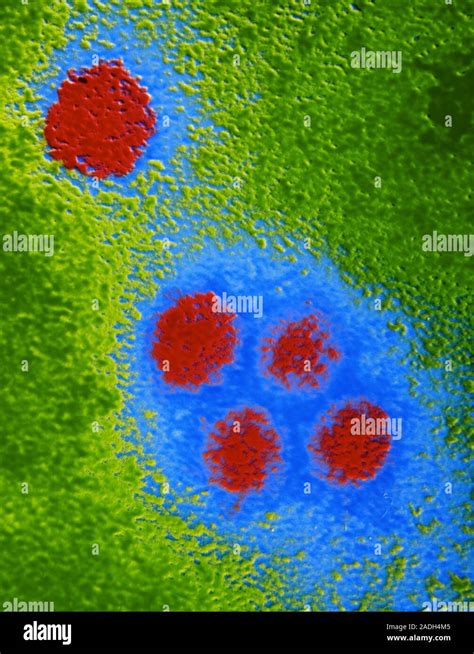 Dengue Virus Coloured Transmission Electron Micrograph Of Negatively