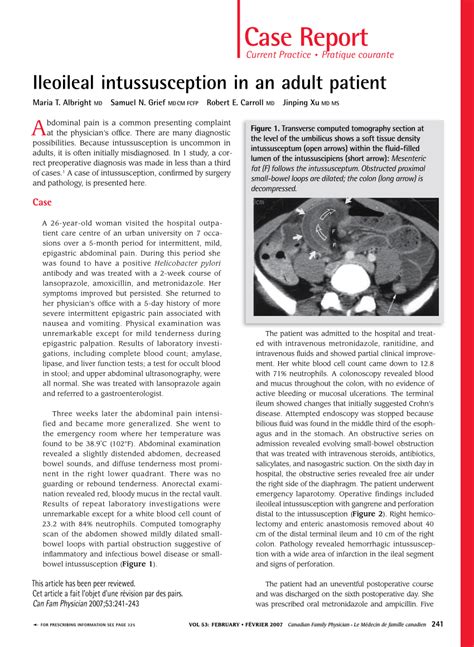 PDF Ileoileal Intussusception In An Adult Patient