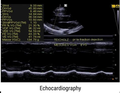 Ultrasound Physics - Medical Professionals