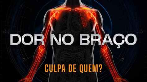 Como Avaliar E Tratar Os Causadores Da Dor Cervical Que Irradia Para Os