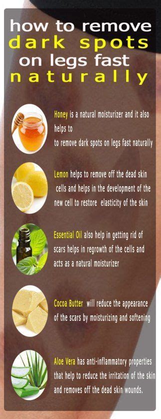 How To Remove Dark Spots On Legs Fast Naturally Dark Spots On Legs