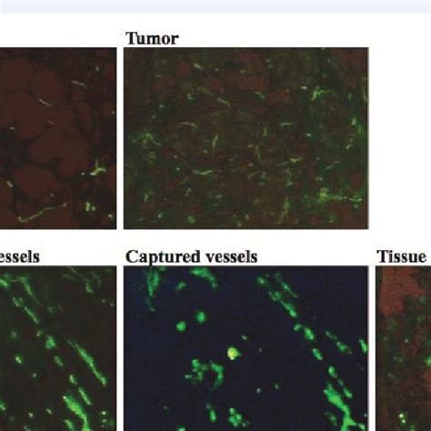 Isolation Of Microvessels By Lcm A Microscopic View Magn X Of