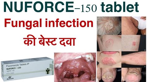 Nuforce 150 Tablet Uses In Hindi How To Use Fluconazole Tablet Fluka