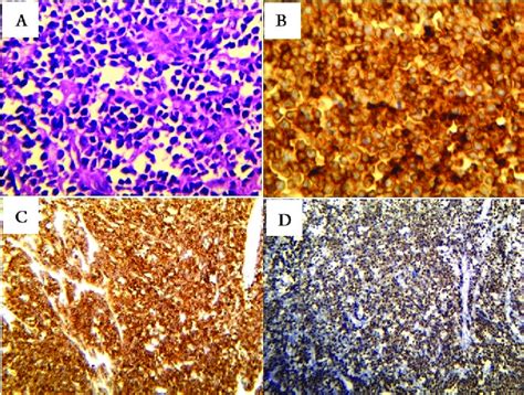 Pathological And Immunohistochemical Assessments Of The Specimen