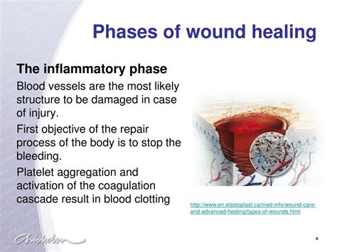 PPT - Physiology of wound healing PowerPoint Presentation, free download - ID:2079549