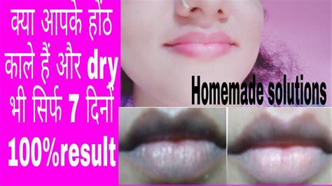 Get Baby Soft Pink Lips In 7 Days 100 Work Lip Ko Pink Karne Ka