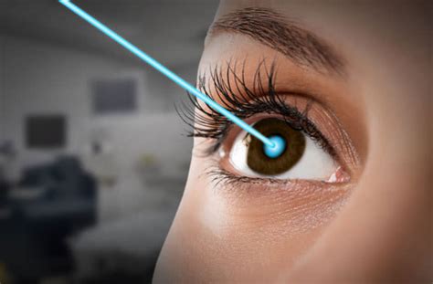 Lasik Eye Surgery A Complete Procedure Guide All About Vision