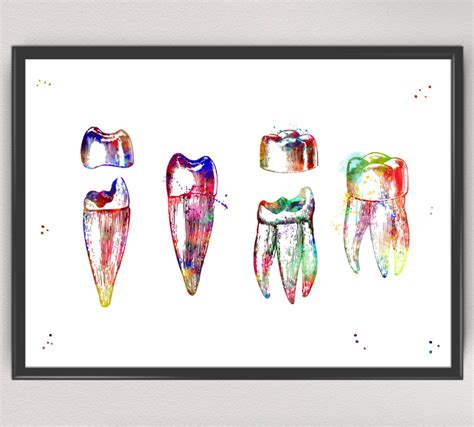 Teeth Reconstruction Dental Watercolor Print Medical Dental Art Human ...