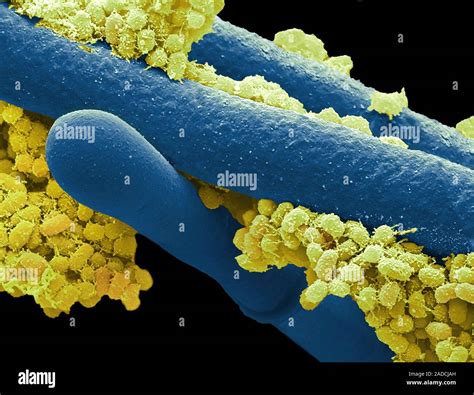 Camembert Rind Coloured Scanning Electron Micrograph Sem Mesophilic