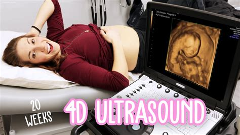 20 Weeks Pregnant 3d Ultrasound