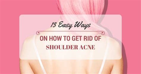 13 Really Easy Ways To Get Rid Of Shoulder Acne