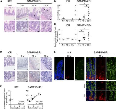 Abnormal Paneth Cells Increase During Disease Progression In