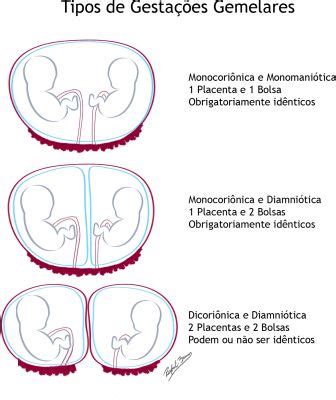 Pin em Gestação parto e afins