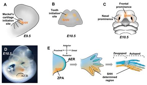 Cells Free Full Text Shh Signaling Pathway Drives Pediatric Bone