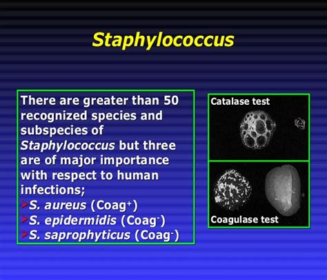 Staphylococcuss Causes Symptoms Treatment Diagnosis And Prevention ...