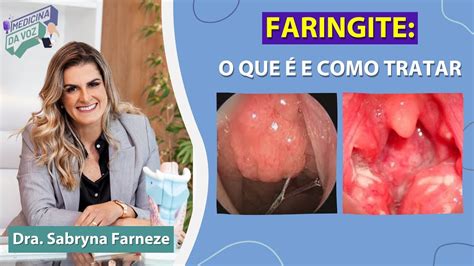 Faringite O Que E Como Tratar Youtube