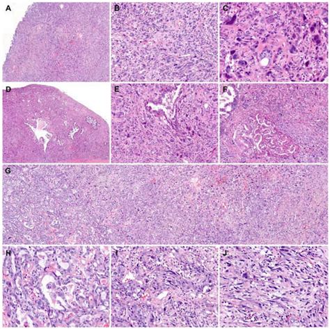 Diagnostics Free Full Text Primary Retroperitoneal Mucinous