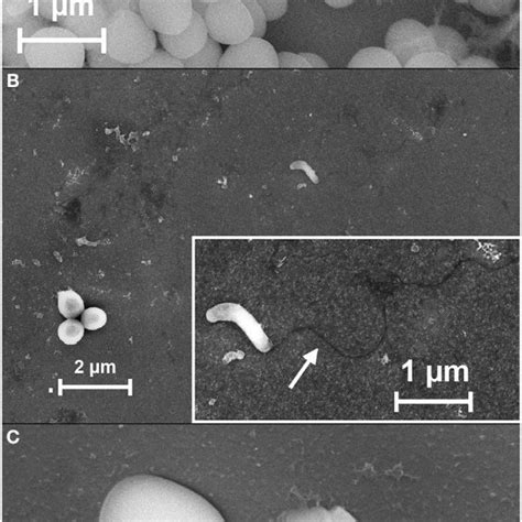 Predation Of B Bacteriovorus On “static” Biofilm Of S Aureus Sem