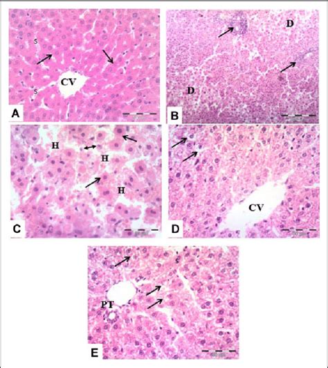 Photomicrographs Of The Liver Tissues A And B The Control Group