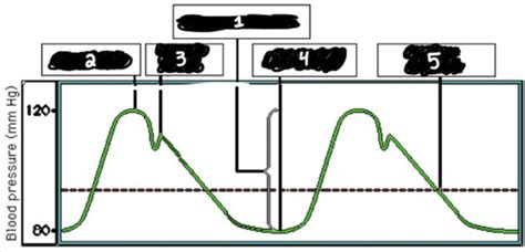 Blood Pressure Lab Flashcards Quizlet