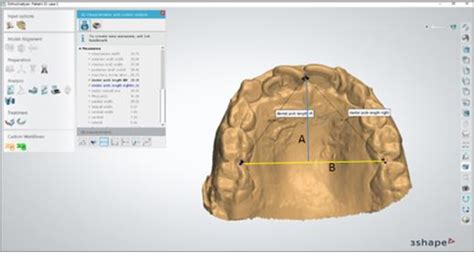 Figure 1 From Assessment Of Maxillary And Mandibular Dental Arches