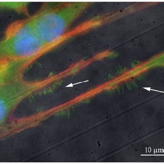 Filopodia formation in endothelial cells on a nanogroove substrate ...