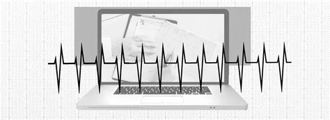 What Is An rSR Prime (rSR') Pattern On An ECG? | Executive Electrocardiogram Education