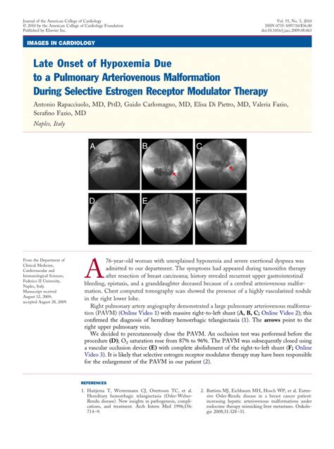 PDF Late Onset Of Hypoxemia Due To A Pulmonary Arteriovenous