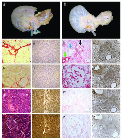 Characterization Of Decellularized Human Pancreas Tissue A Before