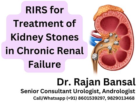 Kidney Cyst Institute Of Urology