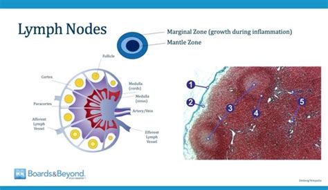 Bandb Non Hodgkin Lymphoma Flashcards Quizlet