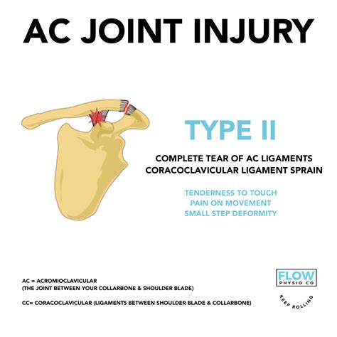 FLOW PHYSIO CO AC Joint Injury In BJJ