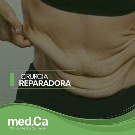 O Que A Cirurgia Pl Stica Reparadora