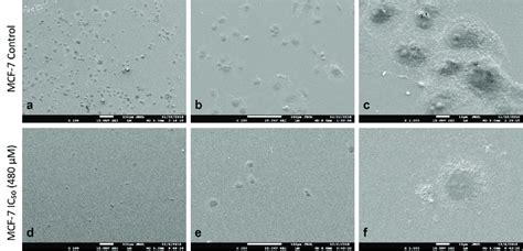 Ultrastructural Changes Of MCF 7 Breast Cancer Cells By SEM Cells Of