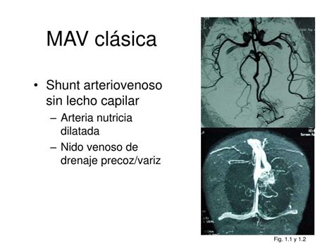 PPT Diagnóstico radiológico de las malformaciones vasculares