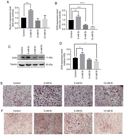 Strontium Promotes Osteogenic Differentiation By Activating Autophagy