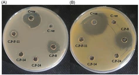 Antibacterial Activity Of Endophytic Bacteria Antibacterial Activity