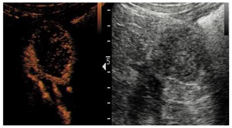 Jcm Free Full Text Qualitative Assessment Of Contrast Enhanced