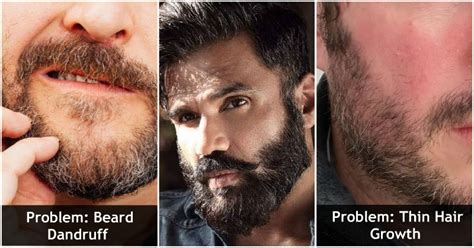 Easy Ways To Deal With The 5 Most Common Beard Problems