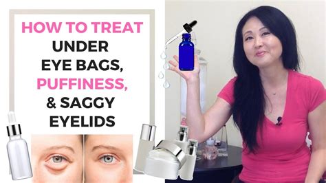 How To Treat Under Eye Bags Puffiness And Saggy Eyelids Youtube