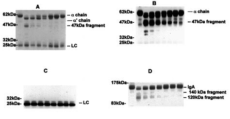 Cleavage Of Human Serum Iga By P Mirabilis Proteinase Aliquots Of