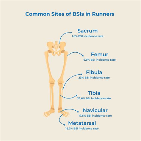 Stress Fractures and Bone Stress Injuries in Runners: What You Need to