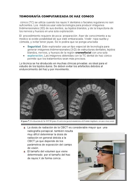 TomografÍa Computarizada De Haz Conico Imagen Pdf Ct Scan