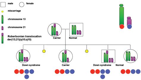 Translocation Down Syndrome Karyotype