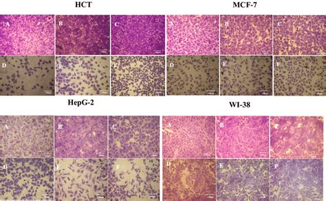 Morphological Characteristics Of Hct Mcf Hepg And Wi Cell