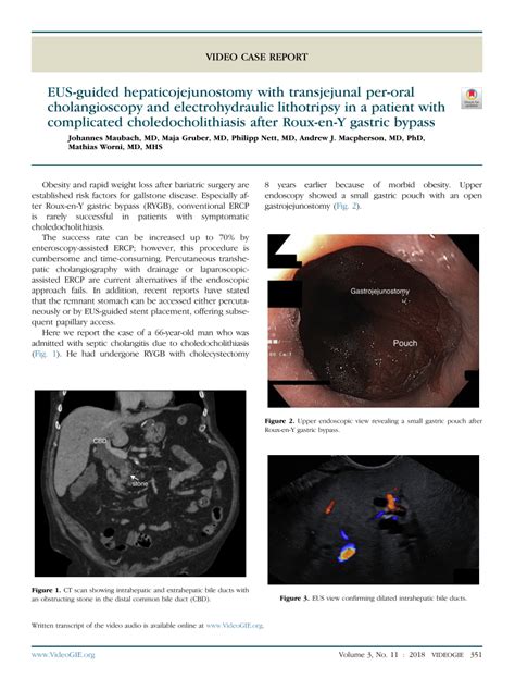 Pdf Eus Guided Hepaticojejunostomy With Transjejunal Per Oral